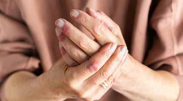 The 6 most common skin conditions (including skin cancer & melanoma)