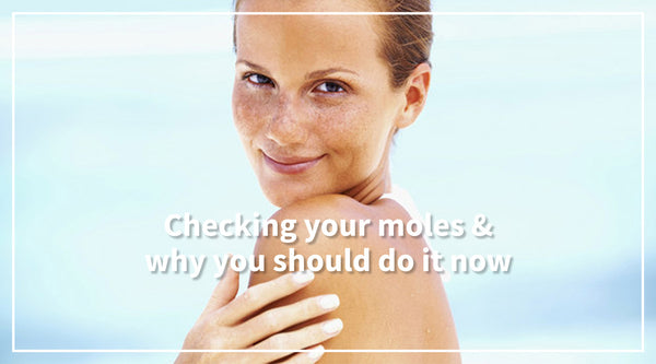 Checking your moles & why you should do it now
