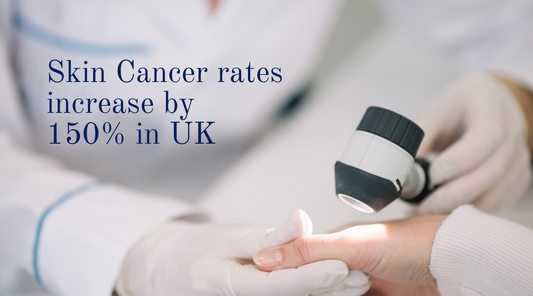 Skin Cancer rates increase 150% in UK