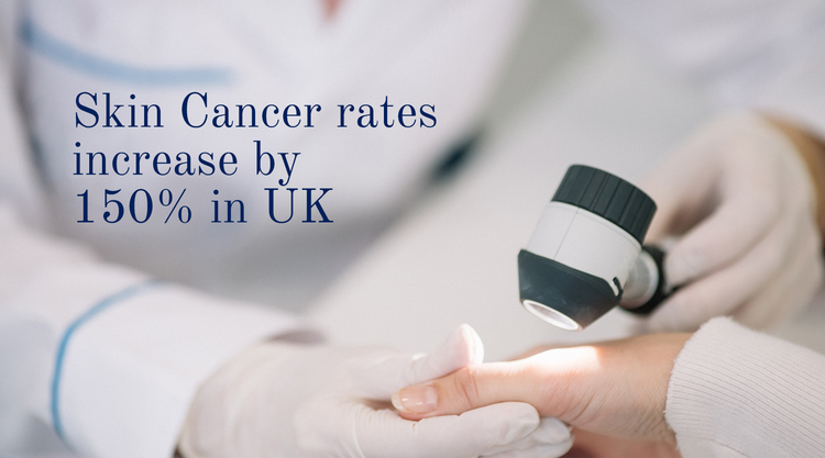 Skin Cancer rates increase 150% in UK Solbari UK