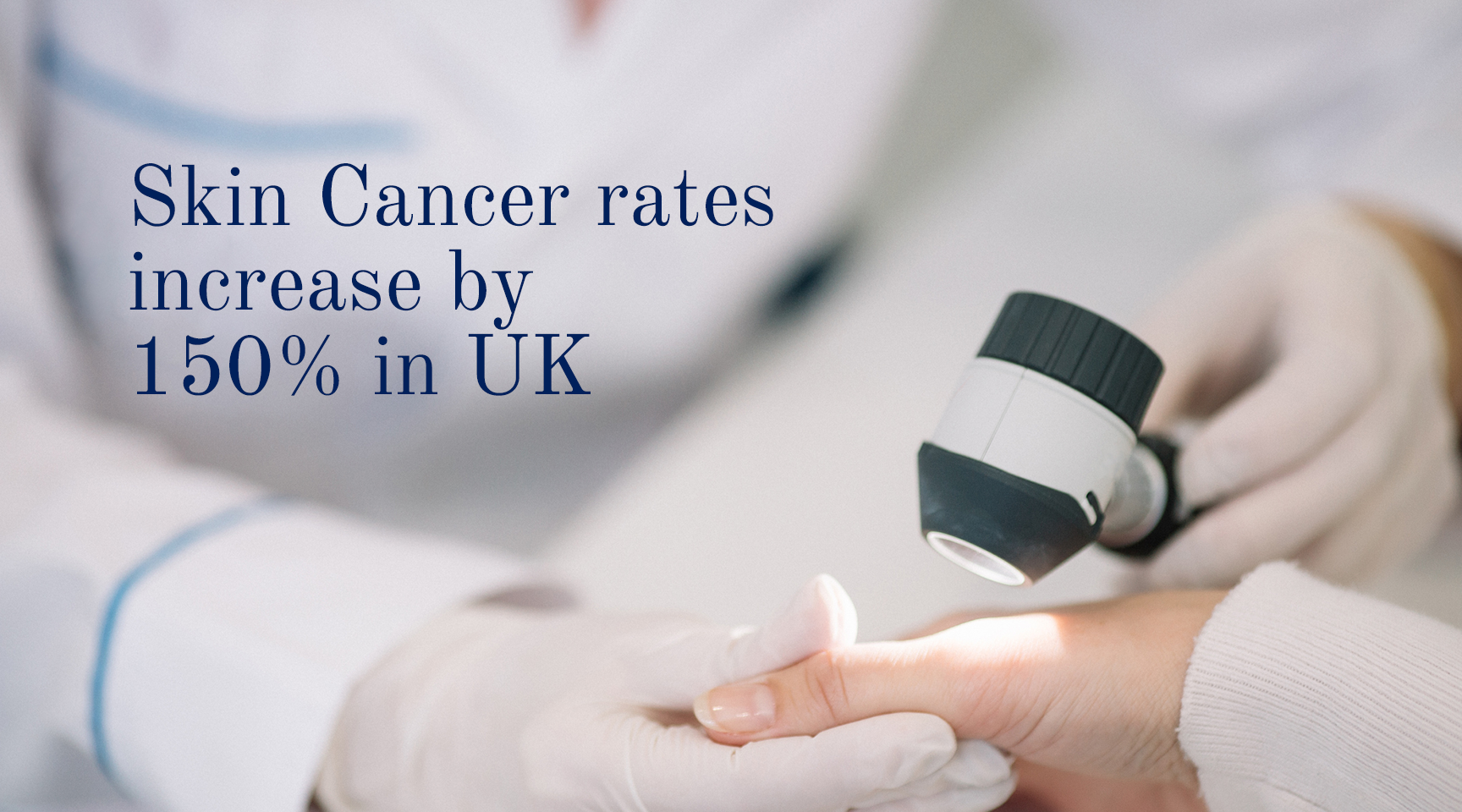 Skin Cancer rates increase 150% in UK – Solbari UK