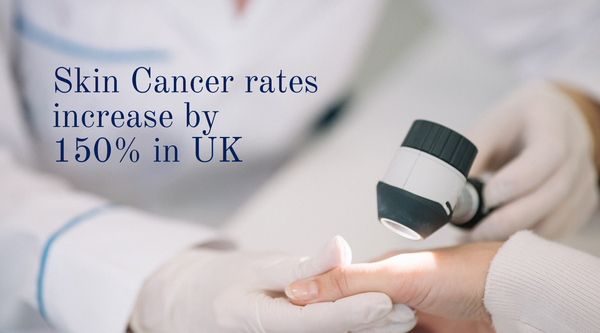 Skin Cancer rates increase 150% in UK