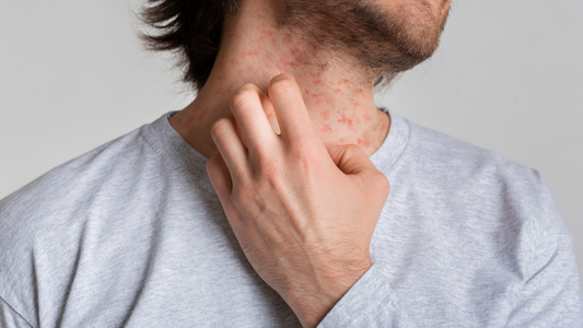 Solbari blog: What is eczema clothing?