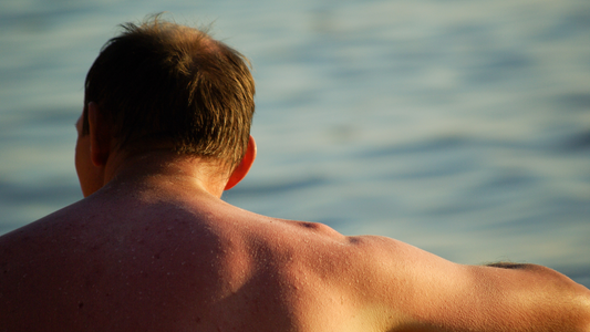 Solbari blog: What is melanoma?