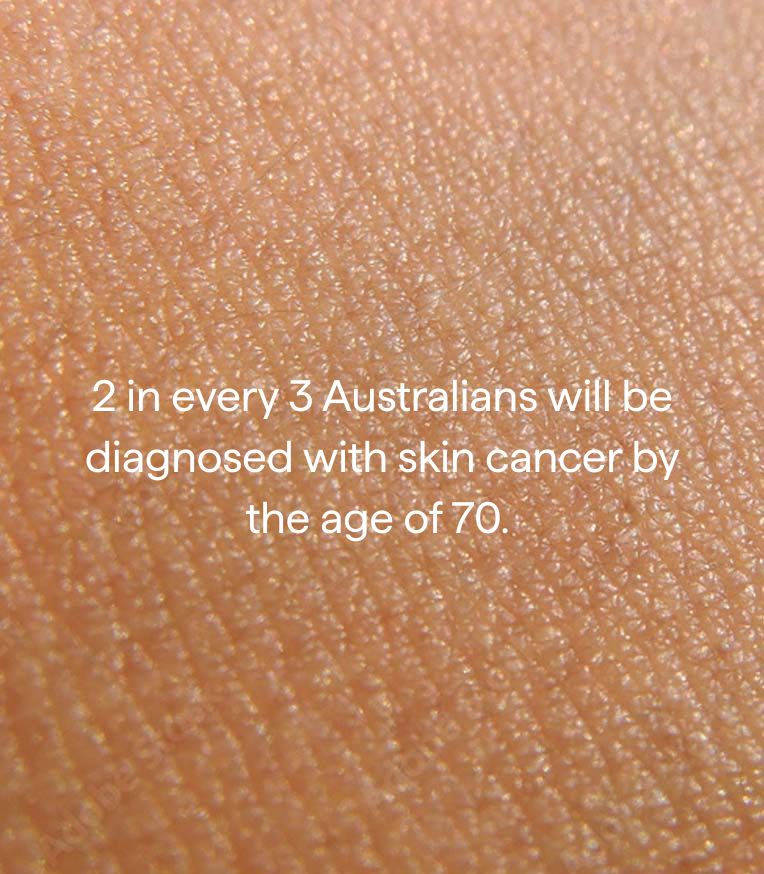Text on skin texture stating that 2 in every 3 Australians will be diagnosed with skin cancer by the age of 70.