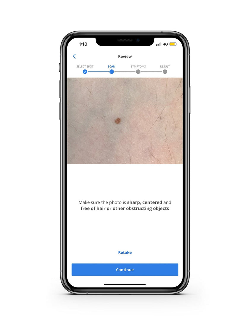 Skin Cancer Detection App